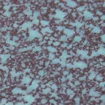 Aurubis
